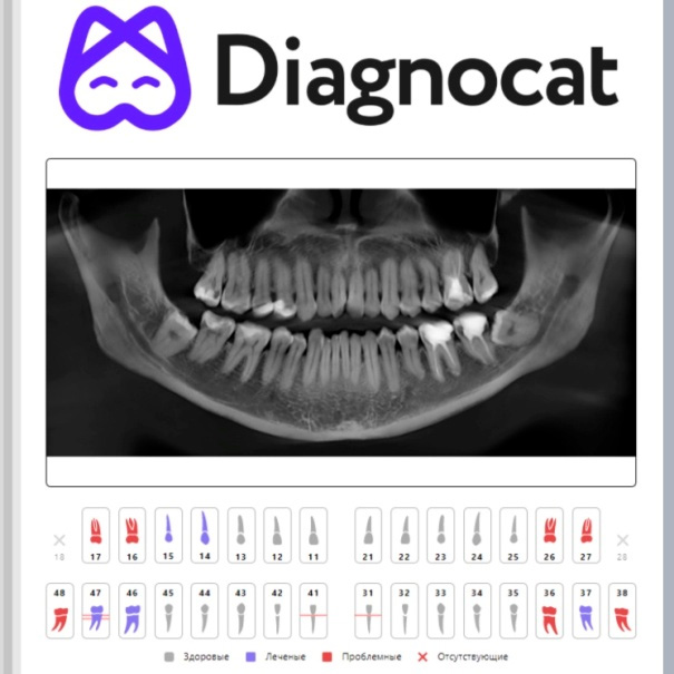 Диагнокат и КТ зубов | Клиника CONFIDENT в VEGAS МКАД Мякинино