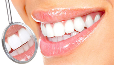 Отбеливание зубов | Клиника CONFIDENT в VEGAS МКАД Мякинино