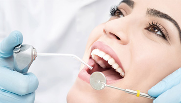 Профессиональная чистка зубов | Клиника CONFIDENT в VEGAS МКАД Мякинино